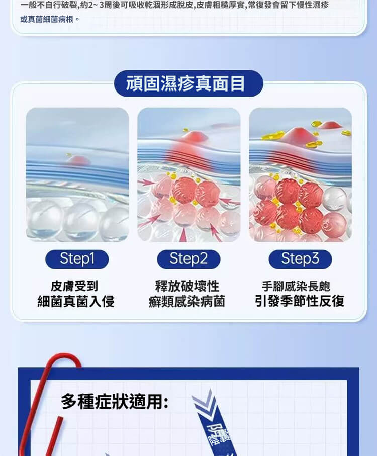 舒克炎抑菌乳膏