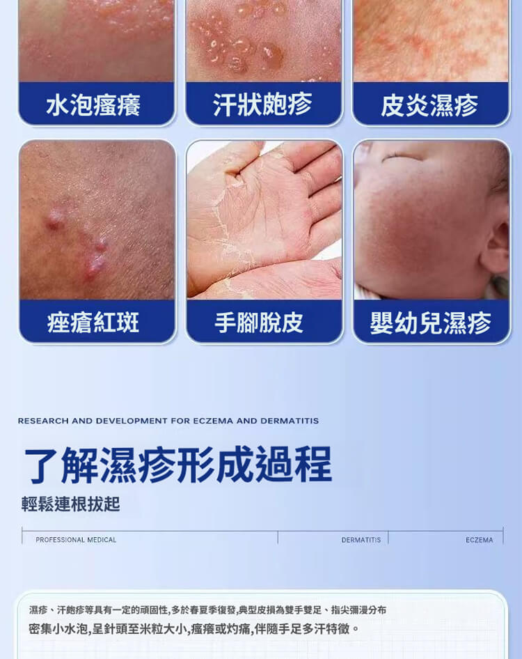 舒克炎抑菌乳膏