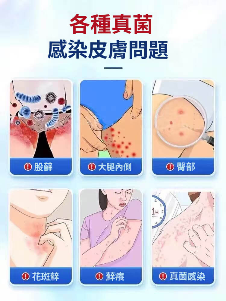 舒克炎抑菌乳膏