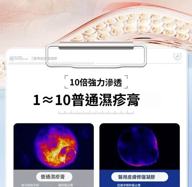 舒克炎抑菌乳膏