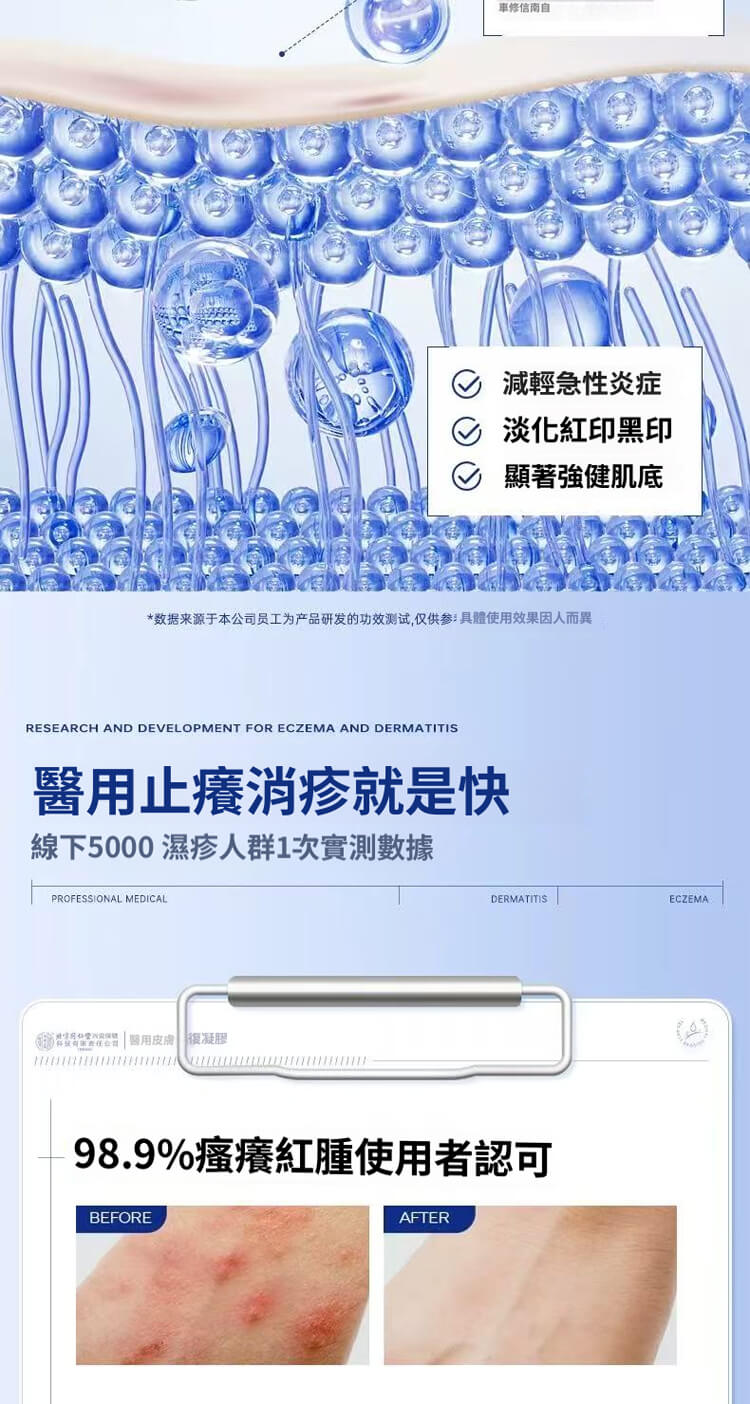 舒克炎抑菌乳膏
